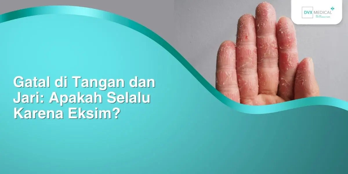 Gatal di Tangan dan Jari: Apakah Selalu Karena Eksim?