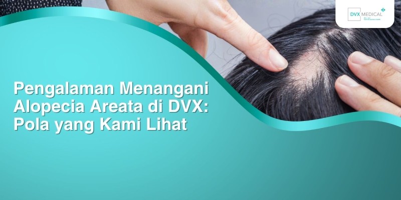 Pengalaman Menangani Alopecia Areata di DVX: Pola yang Kami Lihat