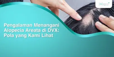 Pengalaman Menangani Alopecia Areata di DVX: Pola yang Kami Lihat
