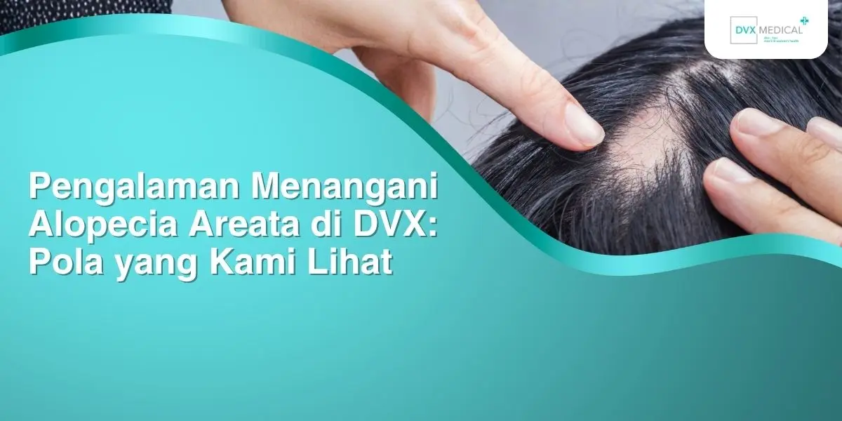 Pengalaman Menangani Alopecia Areata di DVX: Pola yang Kami Lihat