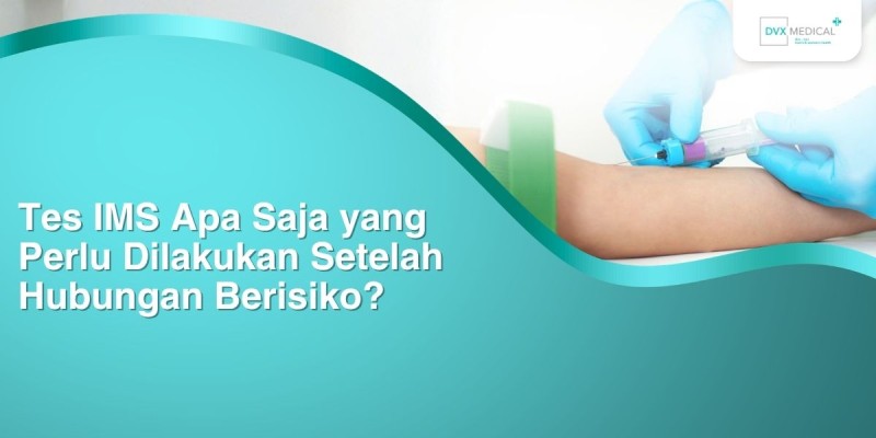 Tes IMS Apa Saja yang Perlu Dilakukan Setelah Hubungan Berisiko?