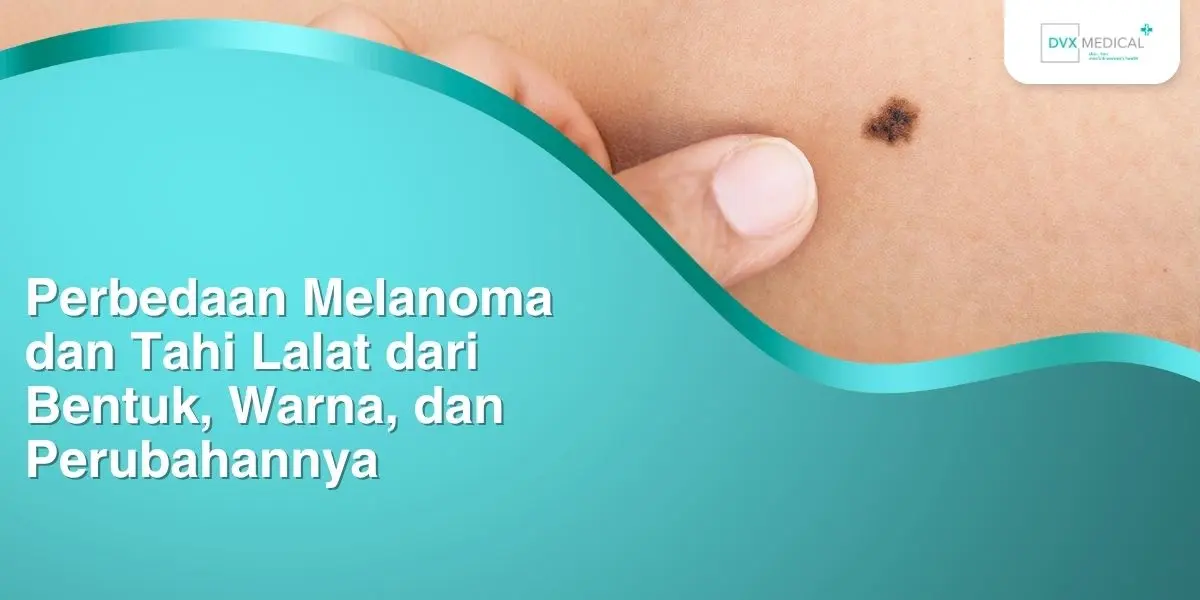 Perbedaan Melanoma dan Tahi Lalat dari Bentuk, Warna, dan Perubahannya