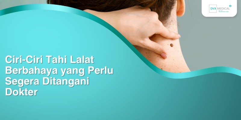 Ciri-Ciri Tahi Lalat Berbahaya yang Perlu Segera Ditangani Dokter