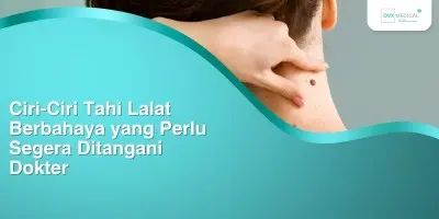 Ciri-Ciri Tahi Lalat Berbahaya yang Perlu Segera Ditangani Dokter