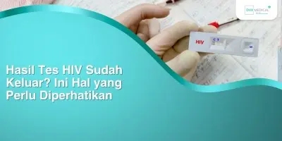Hasil Tes HIV Sudah Keluar? Ini Hal yang Perlu Diperhatikan