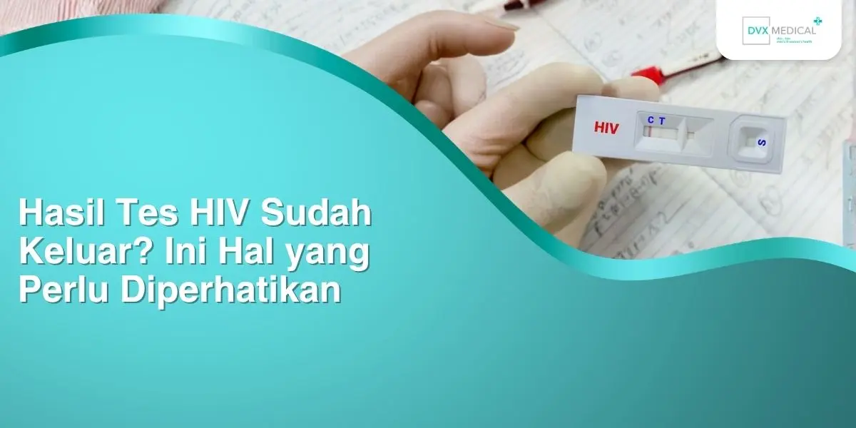 Hasil Tes HIV Sudah Keluar? Ini Hal yang Perlu Diperhatikan