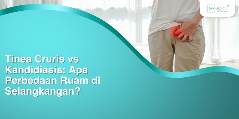 Tinea Cruris vs Kandidiasis: Apa Perbedaan Ruam di Selangkangan?