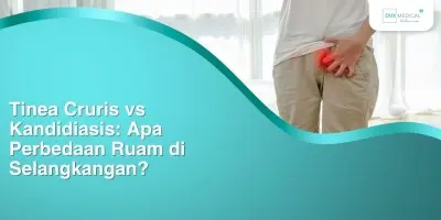 Tinea Cruris vs Kandidiasis: Apa Perbedaan Ruam di Selangkangan?