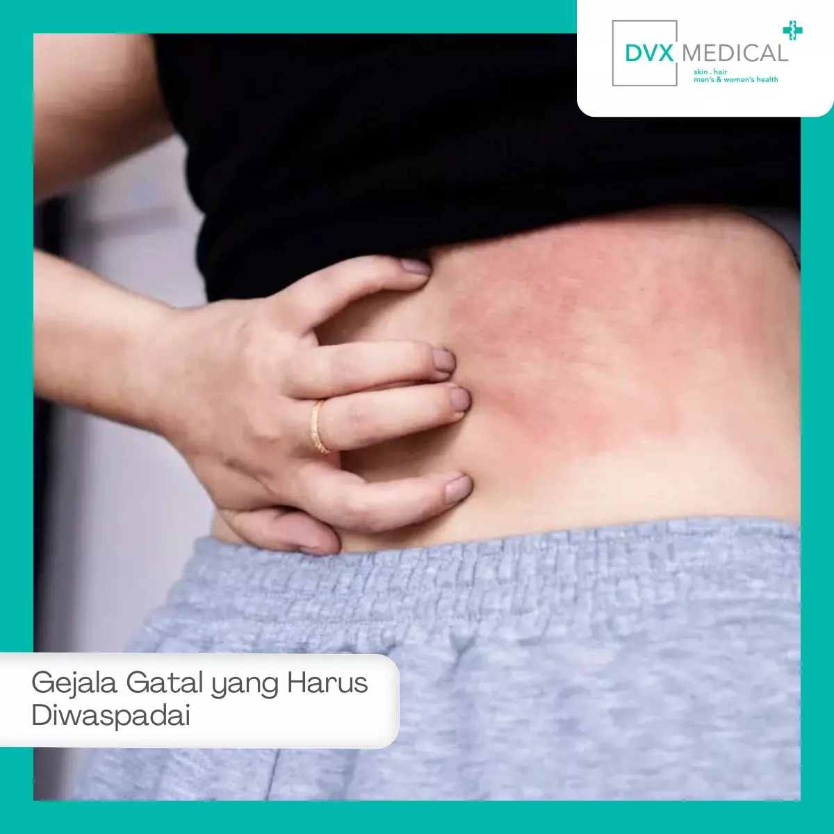 Gejala Gatal yang Harus Diwaspadai