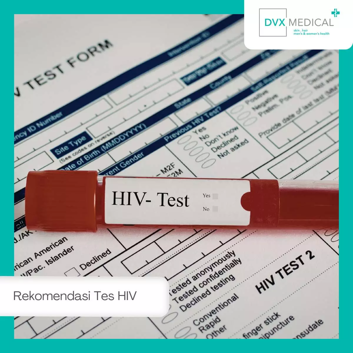 Jenis Tes HIV yang Direkomendasikan