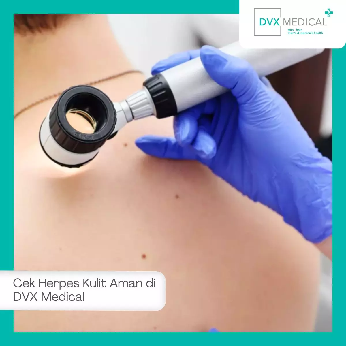Periksa Herpes Kulit Secara Aman di DVX Medical