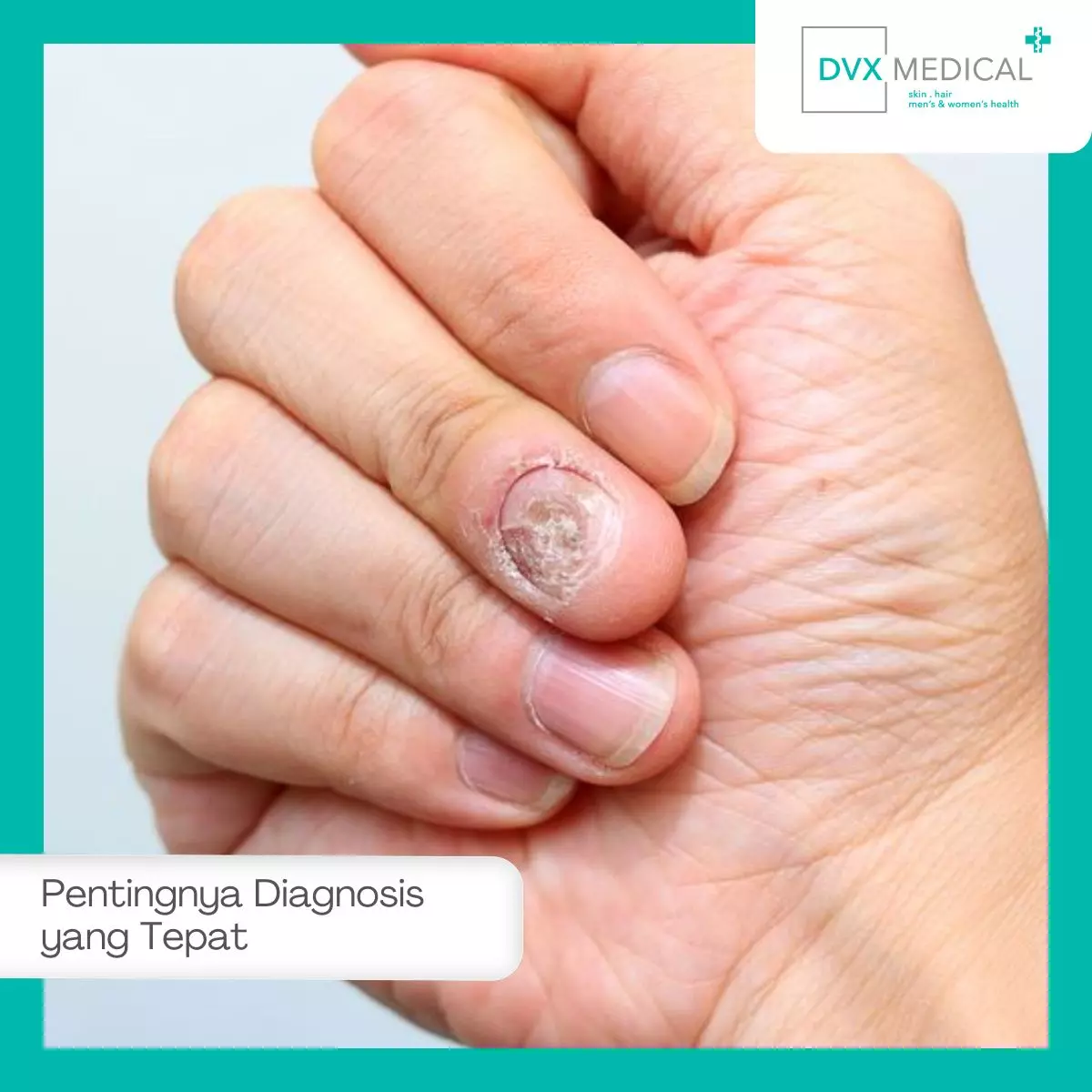 Kenapa Diagnosis Tidak Boleh Asal Menebak?