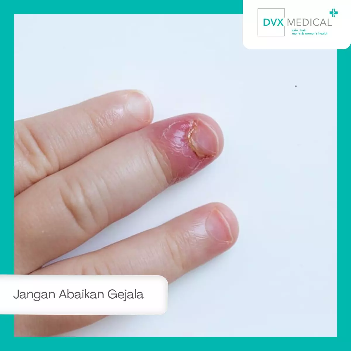 Jangan Abaikan Gejala Berikut