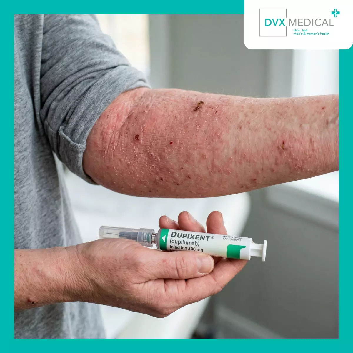 Mengapa Banyak Pasien Akhirnya Mempertimbangkan Terapi Biologik?