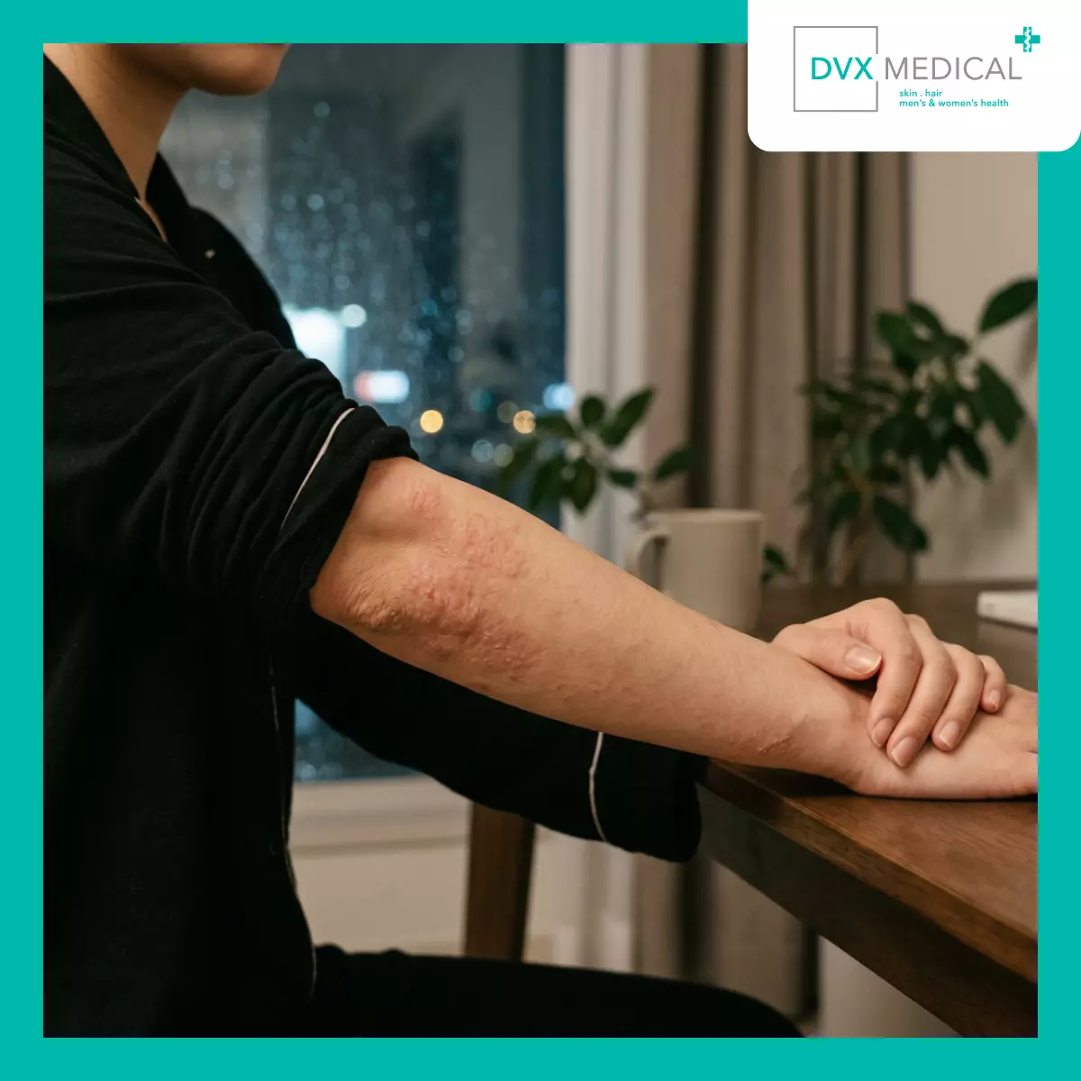 Mengapa Dermatitis Atopik Tidak Dikenali dari Satu Gejala Saja?