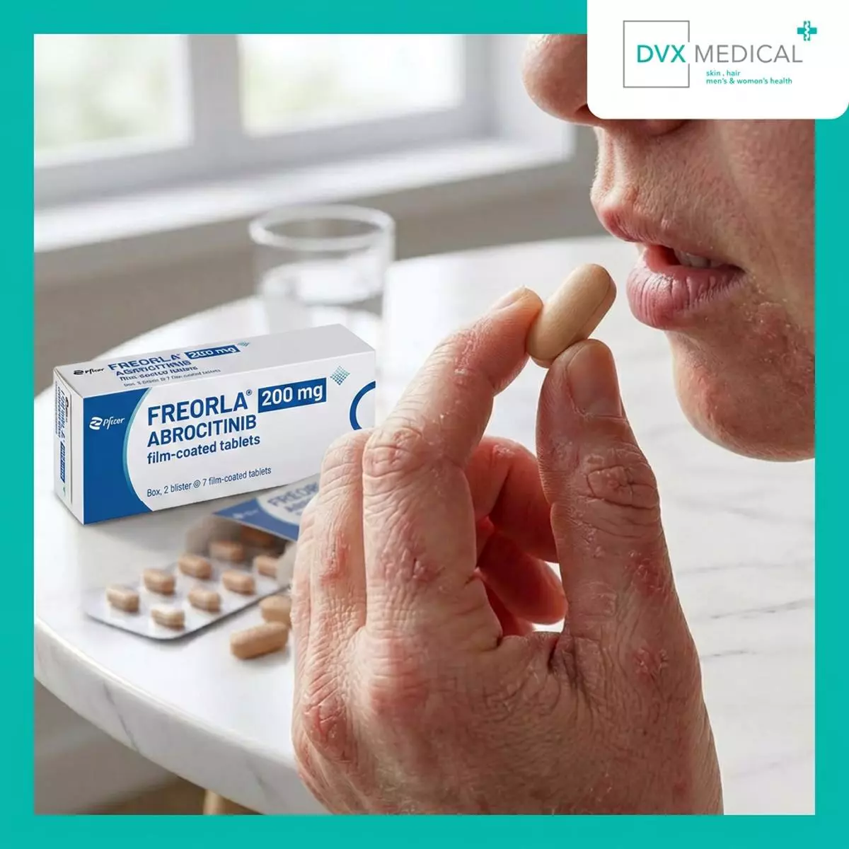 Bagaimana Freorla Digunakan untuk Dermatitis Atopik?