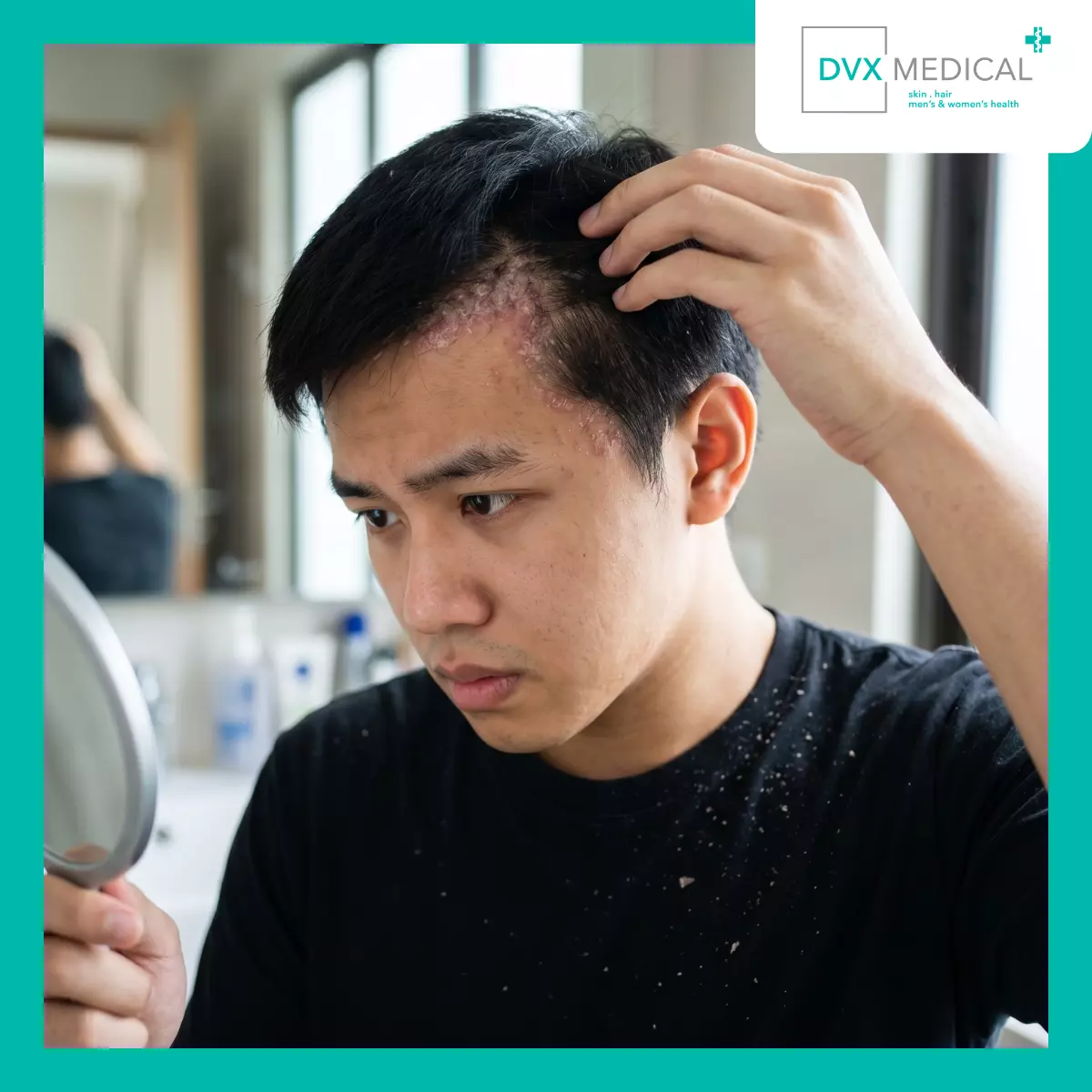 Kapan Psoriasis Mulai Membawa Beban yang Tidak Lagi Masuk Akal?