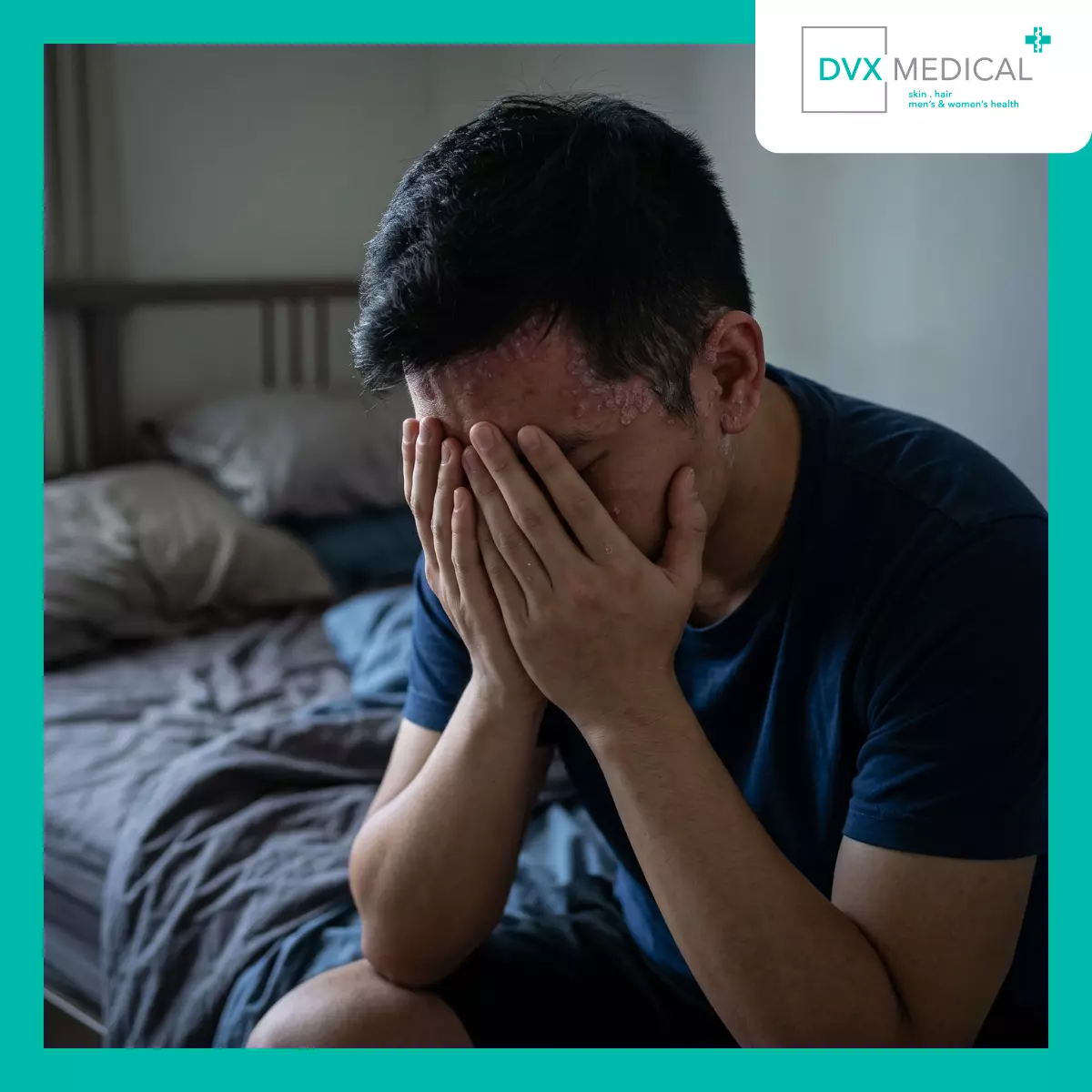 Dampak Apa yang Sering Muncul pada Psoriasis Berat?