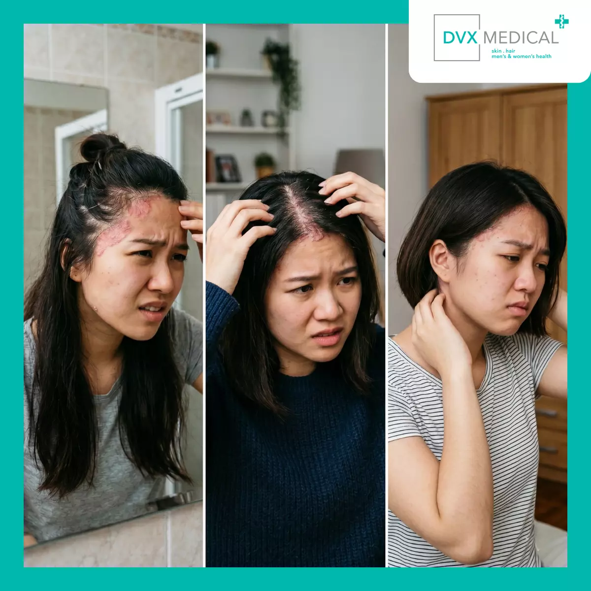 Mengapa Banyak Pasien Yakin Psoriasis Mereka Disebabkan oleh Stres?