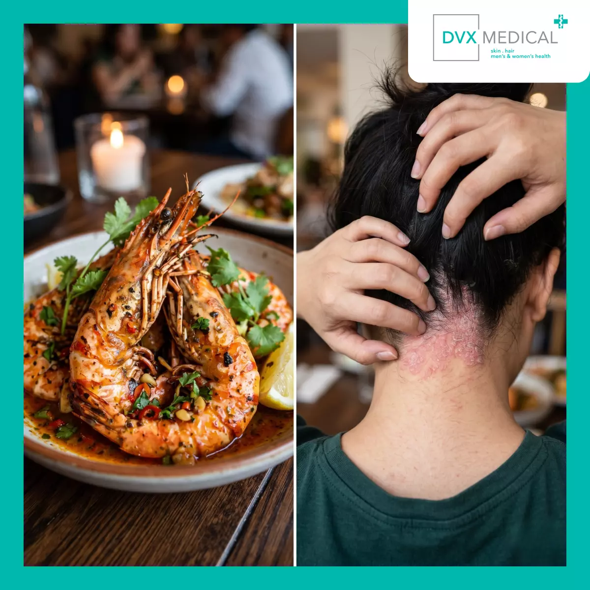 Apa yang Diketahui tentang Makanan dan Aktivitas Psoriasis?