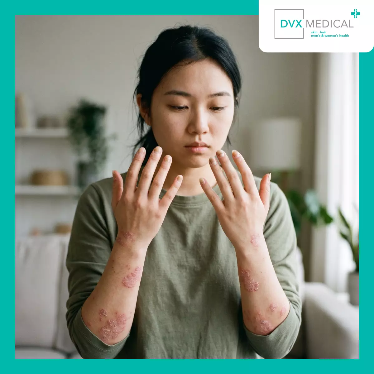 Mengapa Psoriasis Bisa Mengenai Kuku?