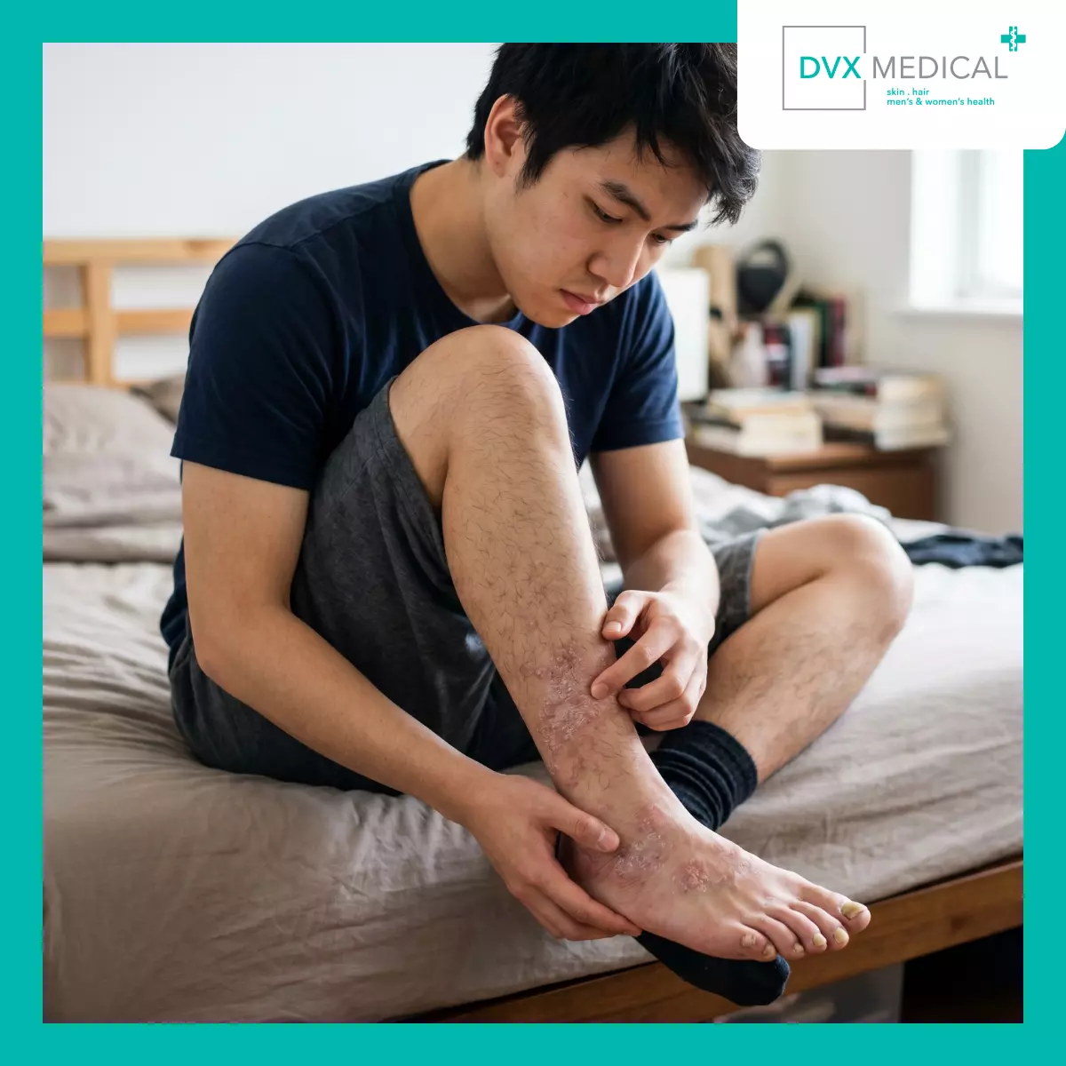 Mengapa Psoriasis Kuku dan Jamur Kuku Sering Sulit Dibedakan?