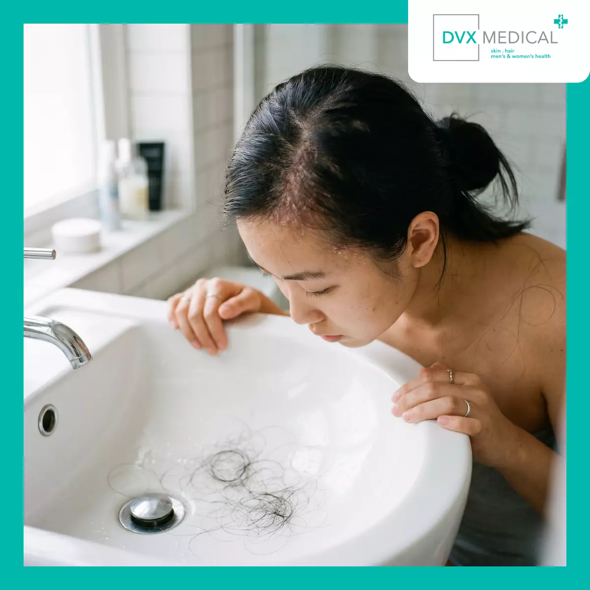Mengapa Psoriasis Kulit Kepala dan Kerontokan Rambut Sering Muncul Bersamaan?