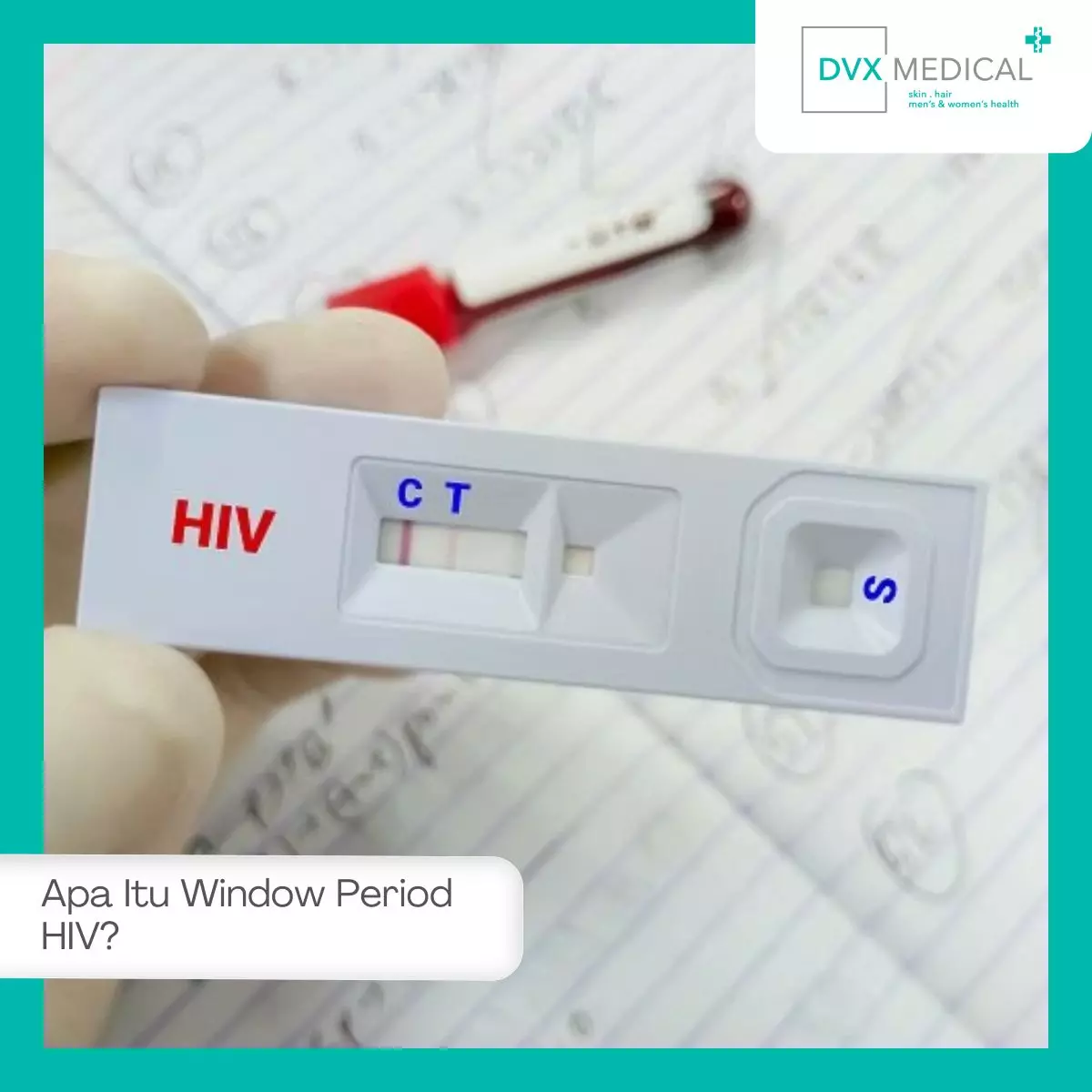 Apa Itu Window Period HIV?
