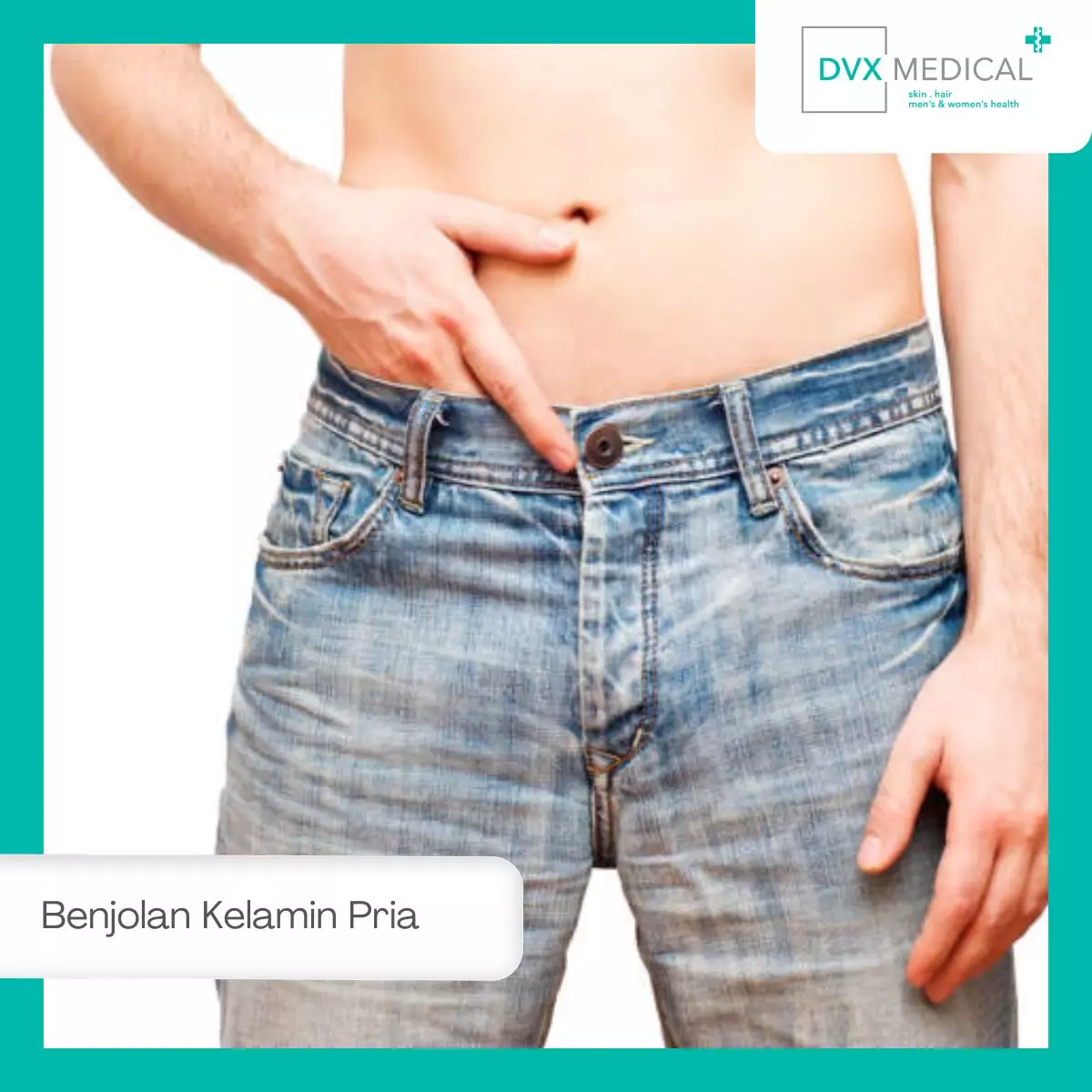 Kapan Benjolan di Penis Perlu Diperiksa?