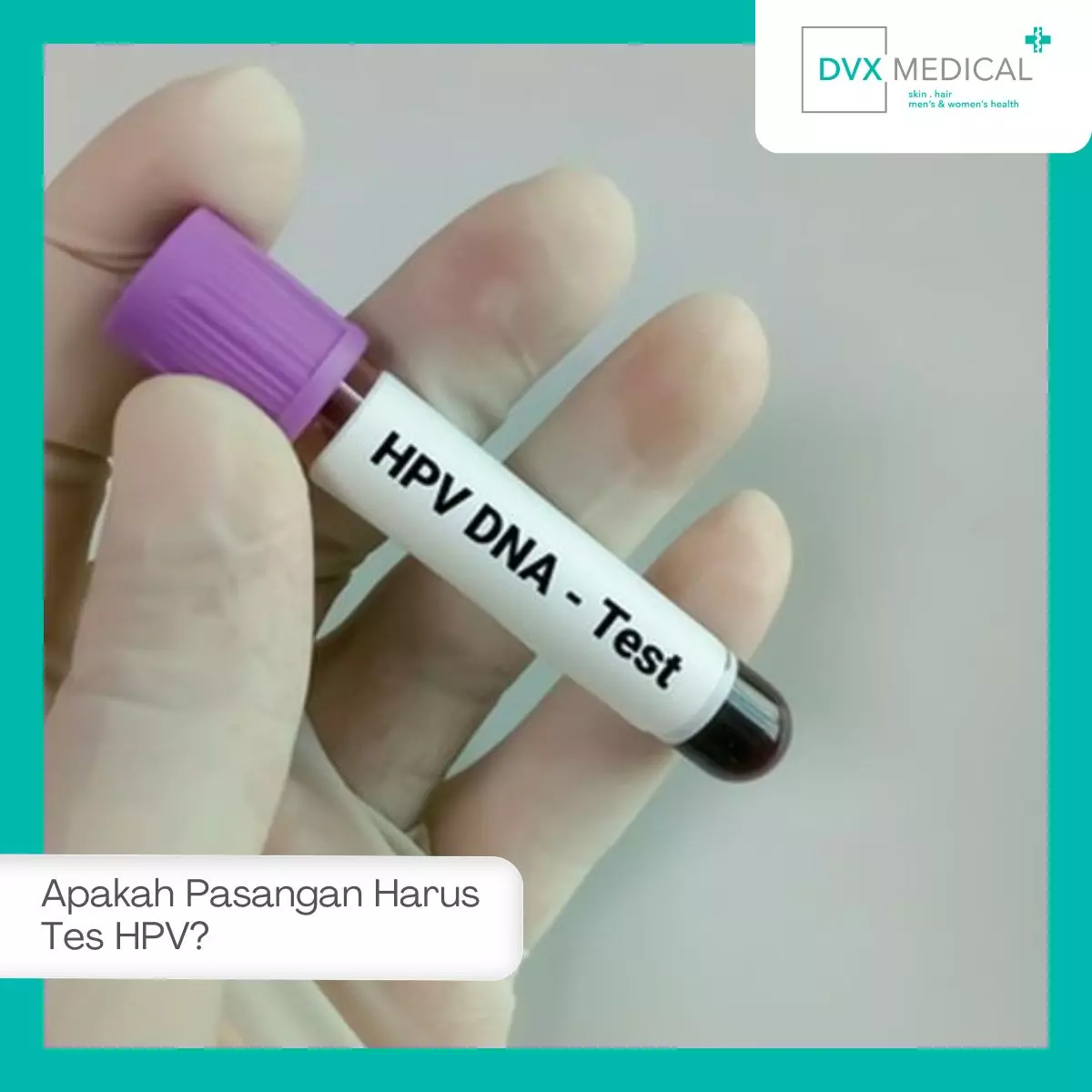 Apakah Pasangan Harus Tes HPV?