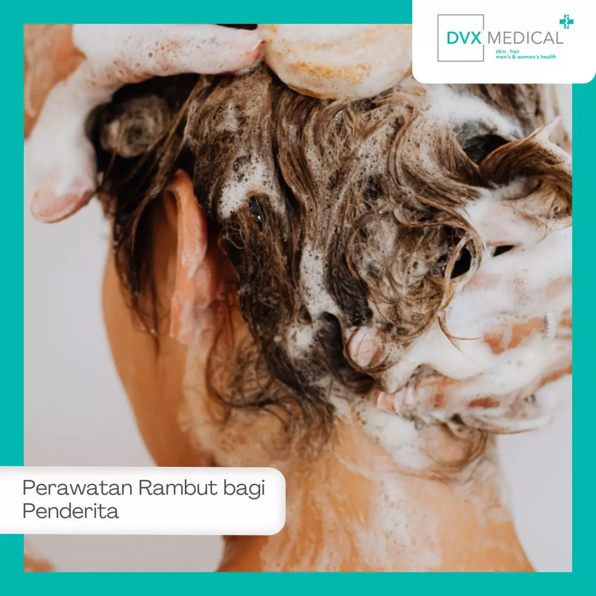 Tips Merawat Rambut dan Kulit Kepala bagi Penderita