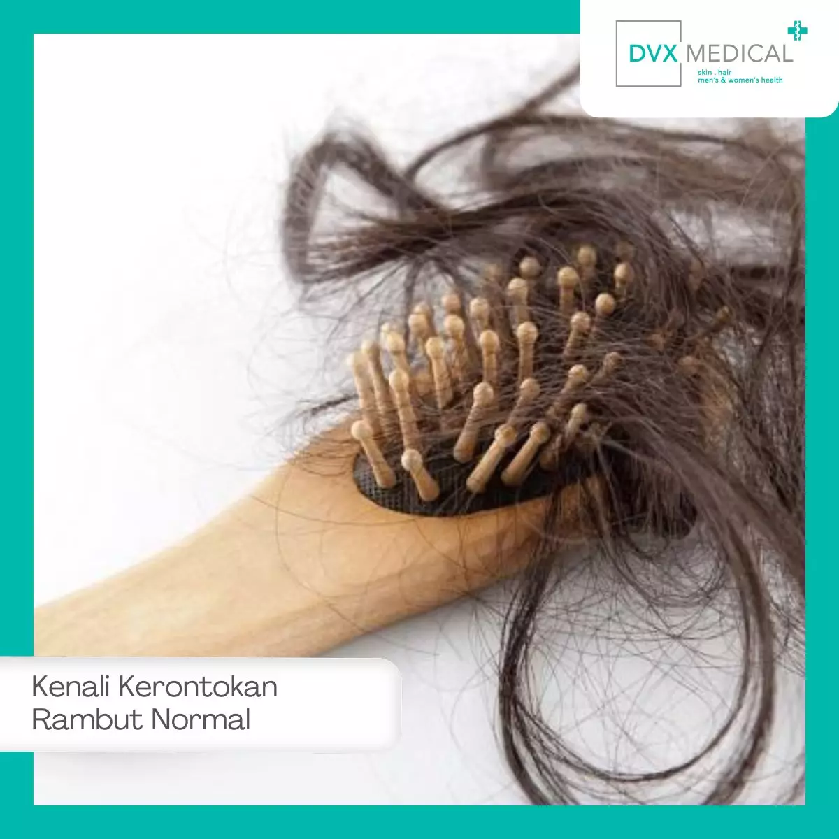 Kenali Dulu: Kapan Kerontokan Rambut Disebut Normal dan Kapan Harus Diwaspadai?