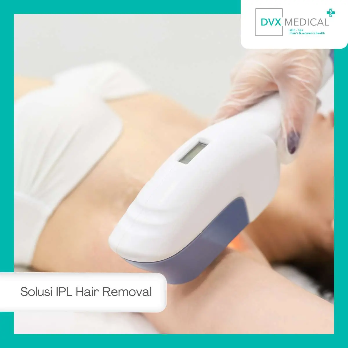 Berapa Kali Sesi IPL Hair Removal Dibutuhkan?