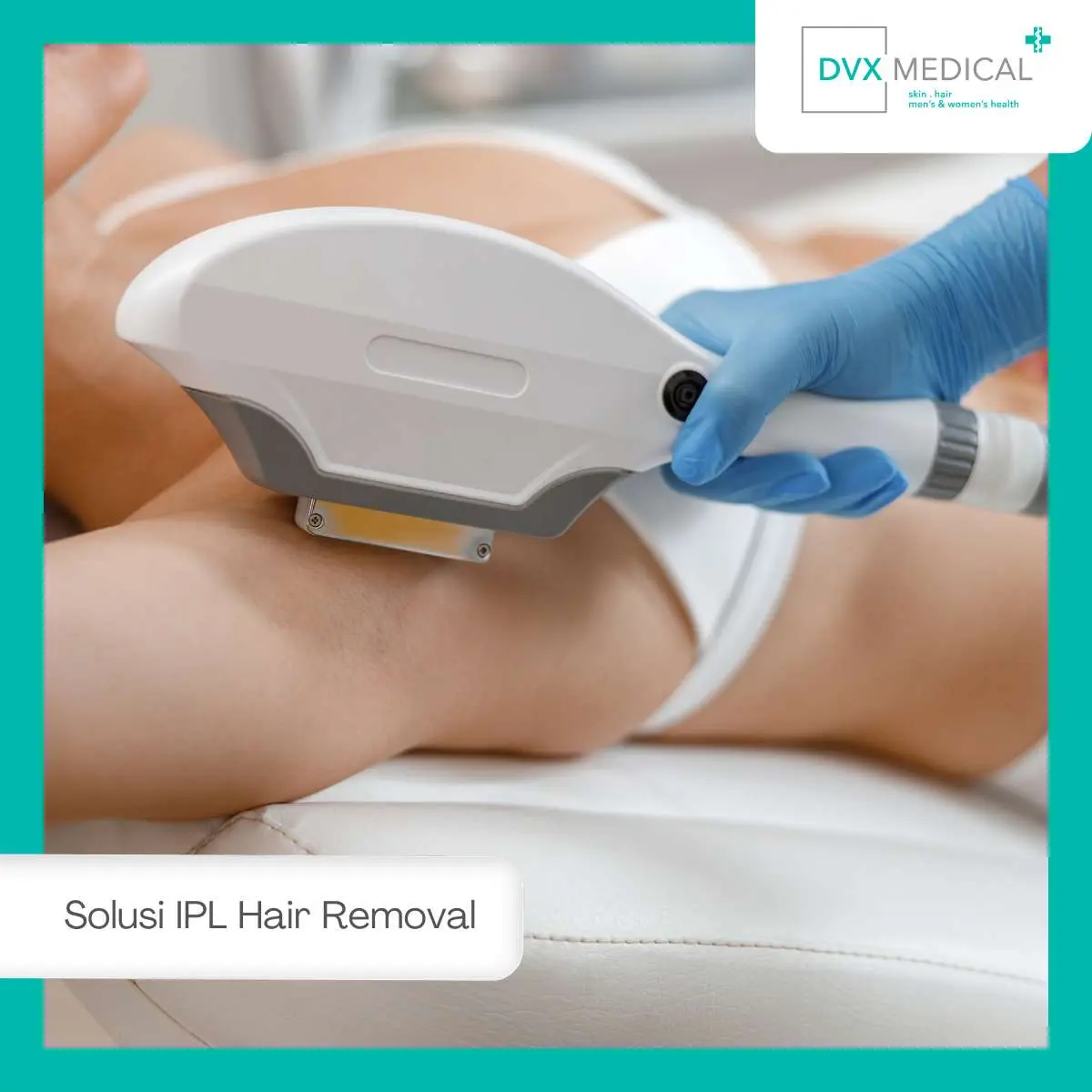 Perawatan Setelah IPL agar Hasil Optimal