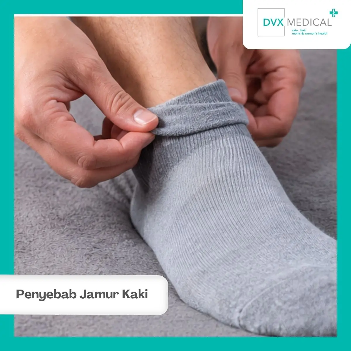 Jamur Kaki Bisa Menular, Bagaimana Cara Penyebarannya?