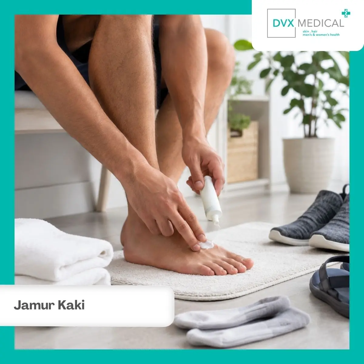 Apakah Jamur Kaki Menular? Pahami Cara Penyebarannya