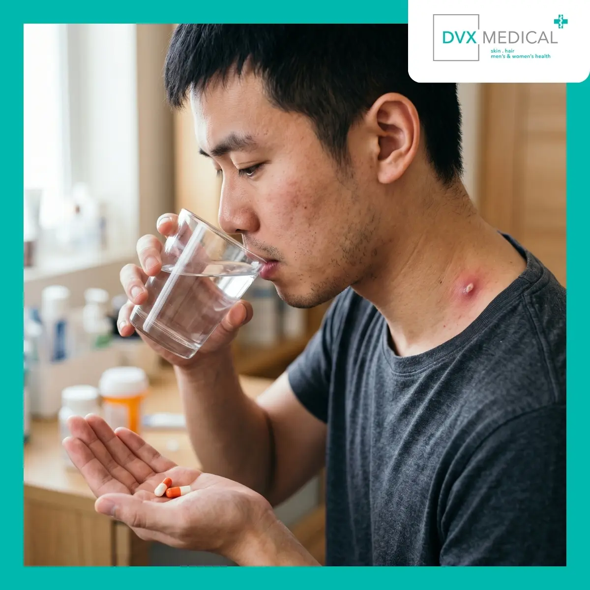 Kenapa Antibiotik Tidak Selalu Menyembuhkan Bisul yang Berulang?