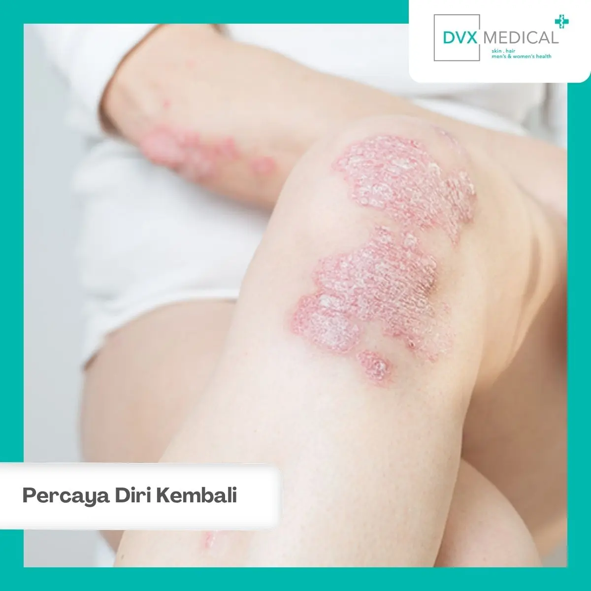 Kembalikan Percaya Diri Anda Bersama DVX Medical