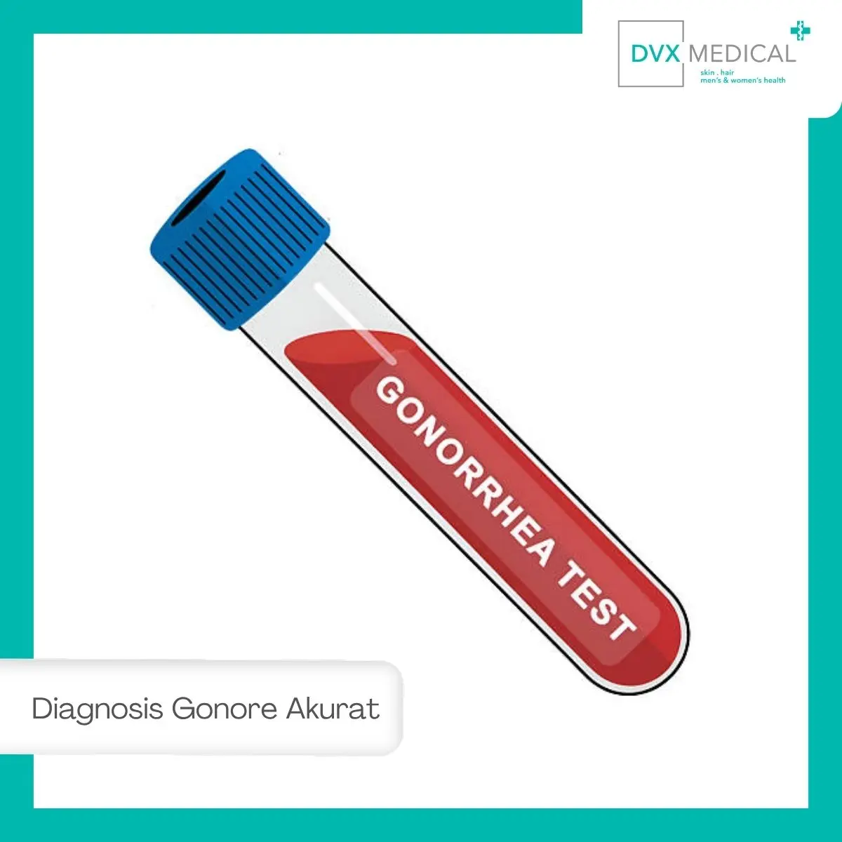 Bagaimana Dokter Memastikan Diagnosis Gonore?