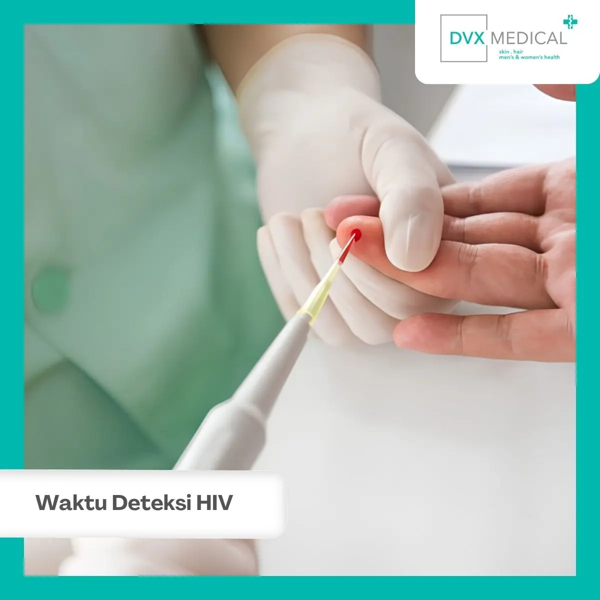 Mengapa Tes HIV Tidak Bisa Langsung Mendeteksi Infeksi?
