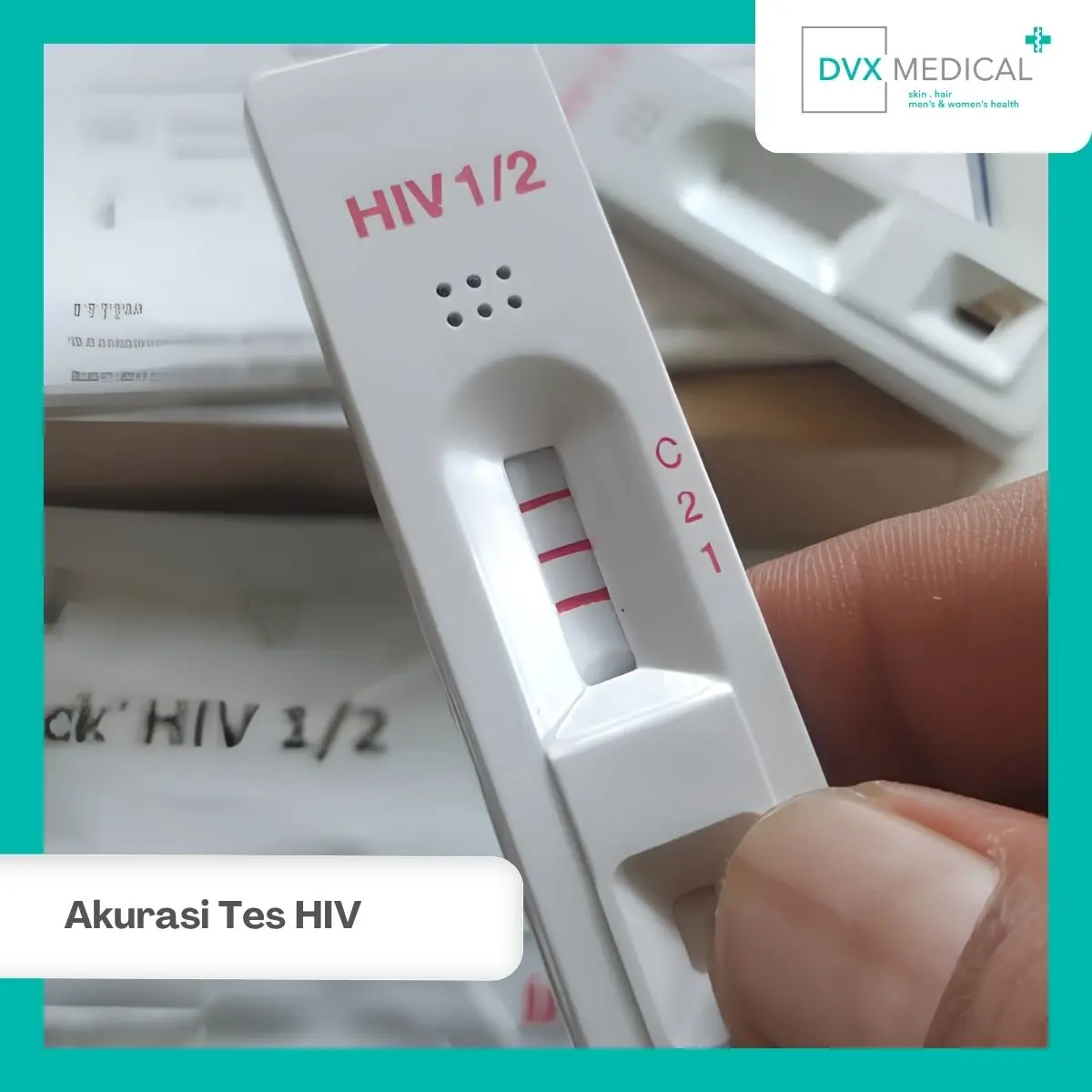 Apakah Tes HIV di Klinik Lebih Akurat daripada di Laboratorium?
