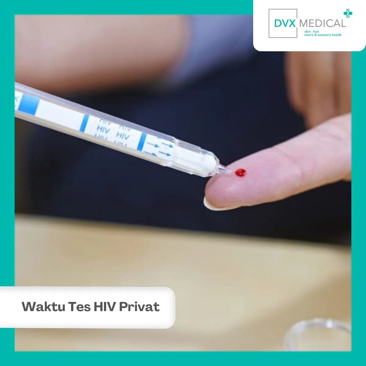 Kapan Sebaiknya Memilih Tes HIV Privat di Klinik?
