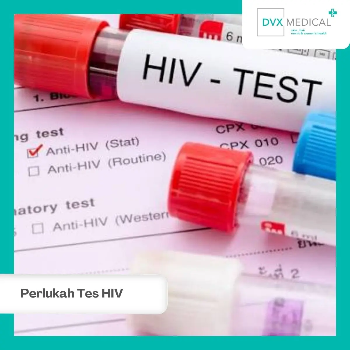 Perlukah Tes HIV Setelah Berganti Pasangan Seksual?