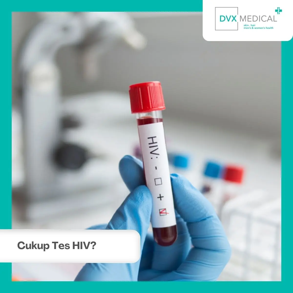 Apakah Cukup Tes HIV Saja?