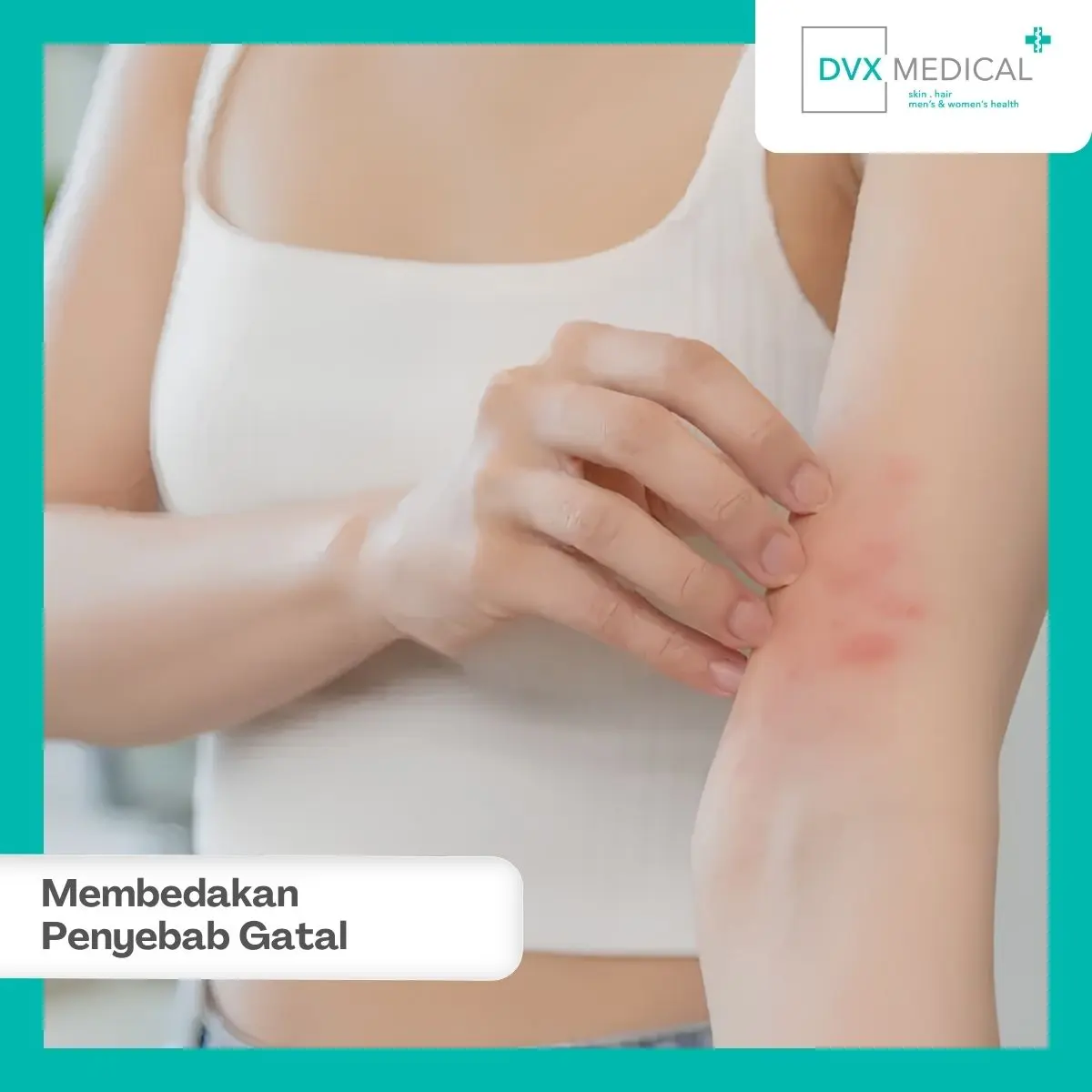 Bagaimana Membedakan Iritasi, Jamur, dan Infeksi?
