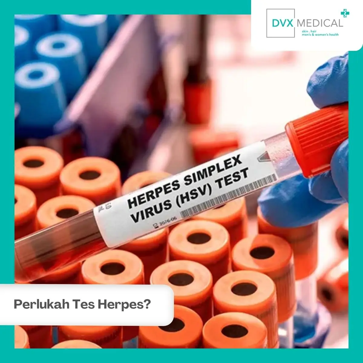 Apakah Herpes dan HPV Perlu Langsung Dites?